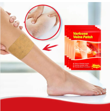 Parche para Varices | Alivio Eficaz y Natural 🩹
