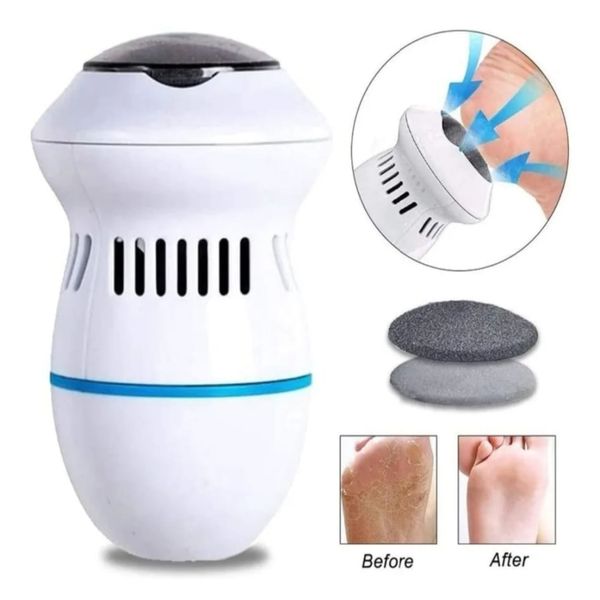 Removedor de Callos Eléctrico con Succión | Pedicura Profesional en Casa